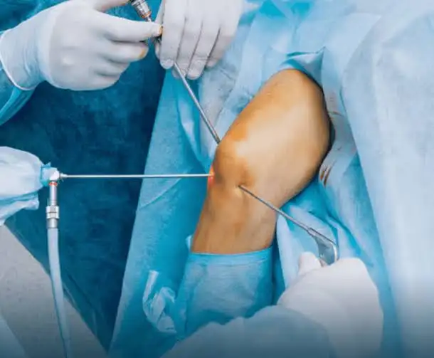 Arthroscopy and Sports Medicine