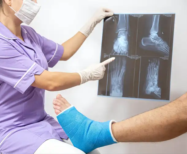 Fracture Care