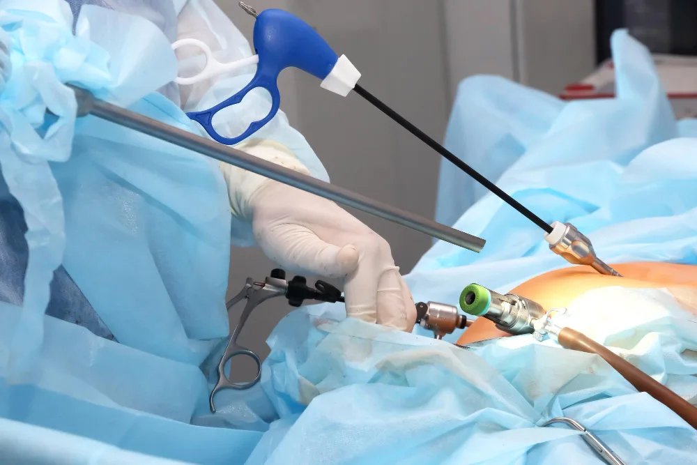 keyhole surgery