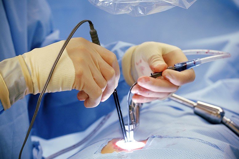 minimally invasive surgeries