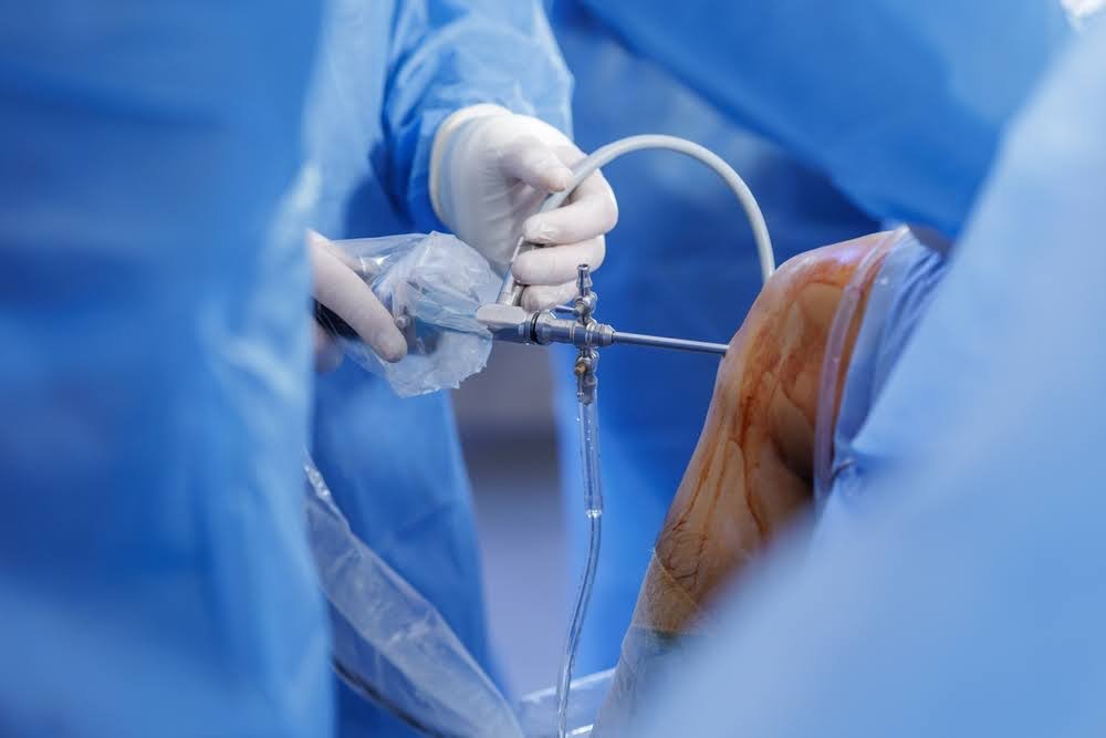 what is arthroscopy