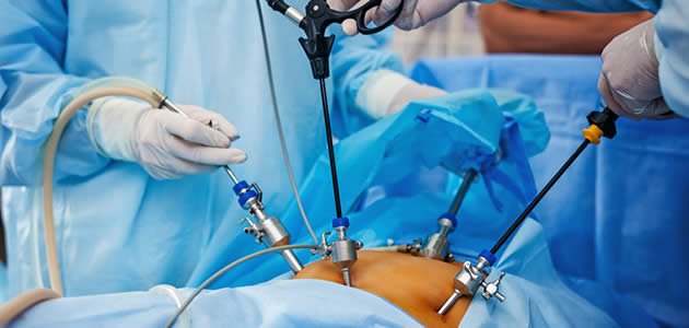 img minimally invasive surgery