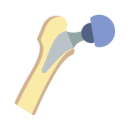 Replacement Arthroplasty
